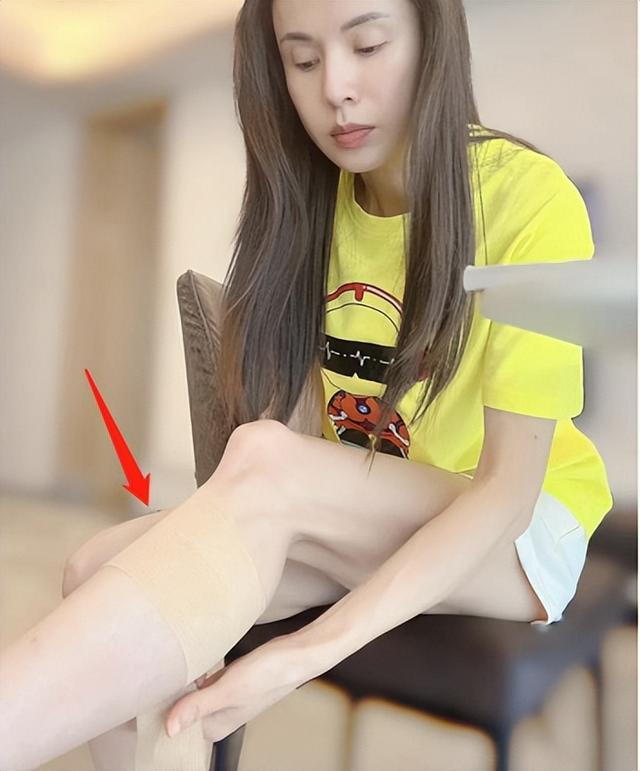 石膏繃帶吧全身骨折小說，繃帶吧 全身石膏圖片？